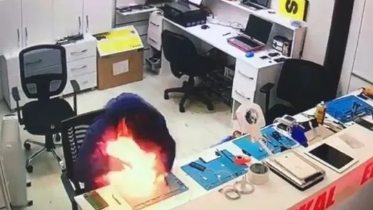 Telefon bataryası patladı, ölümden döndü!