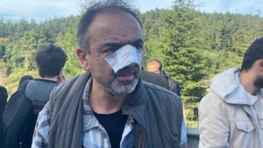 TEM'de yolcu otobüsü tıra çarptı: 13 yaralı