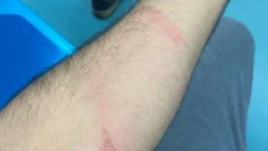 Trafikte tehlikeli paten yolculuğu hüsranla bitti!