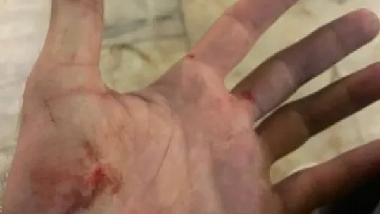 Trafikte tehlikeli paten yolculuğu hüsranla bitti!