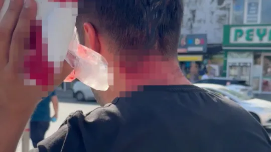 Vekilin cenazesinde darbedilip hastanelik oldu