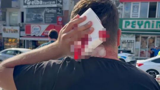 Vekilin cenazesinde darbedilip hastanelik oldu