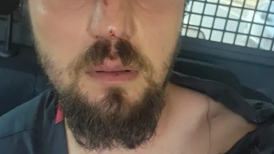 Veteriner hekimi 2 kişi ile darp etmişti, işte ilk açıklama