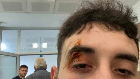 Voleybolculara taraftarlar saldırdı: 3 sporcu yaralandı