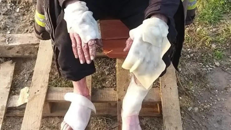 Çıkan yangında elleri ve ayakları yandı