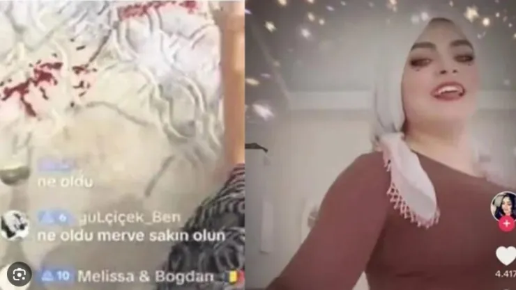 Çocuğu yaralıyken canlı yayın yapan kadına soruşturma