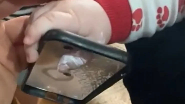 Minik bebeğin parmağı öyle bir yere sıkıştı ki...