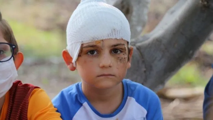 Sokak ortasında kangal dehşeti